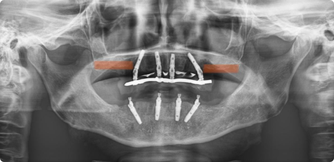 xray-1