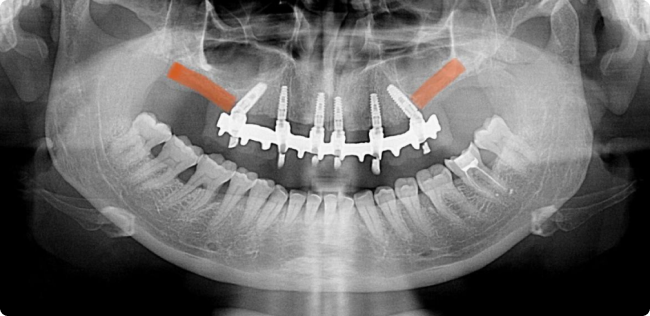 xray-1