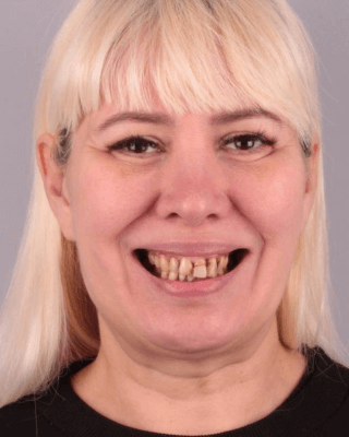 face before
