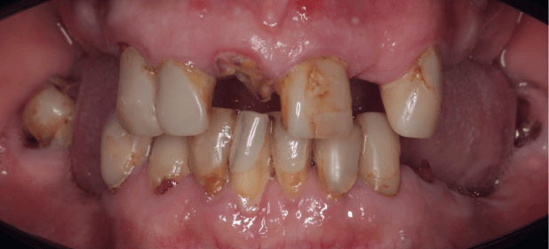 teeth before
